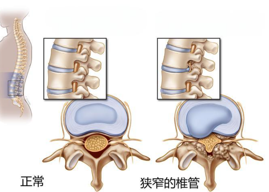 邵陽創(chuàng)傷骨科,邵陽風濕病區(qū),邵陽骨質(zhì)增生,邵陽關節(jié)病區(qū),邵陽頸椎病區(qū)